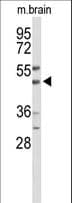 WIPI2 Antibody (aa426-454)