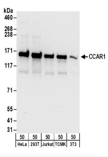 DIS / CCAR1 Antibody (aa1-50)