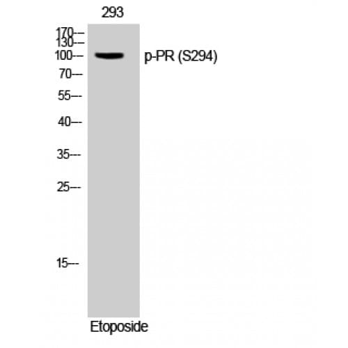 Polyclonal Rabbit anti-Human PR / Progesterone Receptor Antibody (230-310 aa, IF, WB)