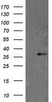 RDH14 Antibody (clone OTI3E1)