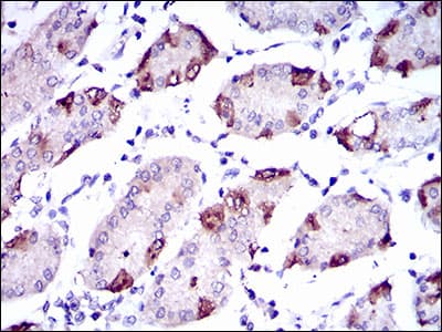 SLC27A5 / BACS Antibody (aa508-570, clone 4B11C10)