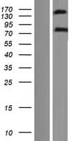 EHBP1 Protein (Over-Expression Lysate Myc-DDK (Flag))