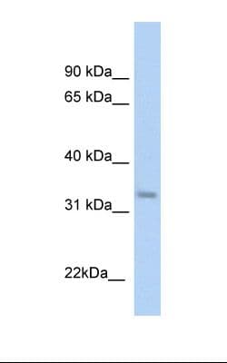 Polyclonal Rabbit anti-Human KHK / Ketohexokinase Antibody (aa201-250, IHC, WB)