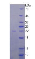 Human BIRC5 / Survivin Protein (Recombinant His, N-Terminal)