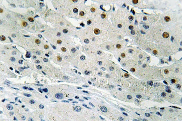 Polyclonal Rabbit anti-Human BP1 / DLX4 Antibody (Gln90, IHC, IF, WB)