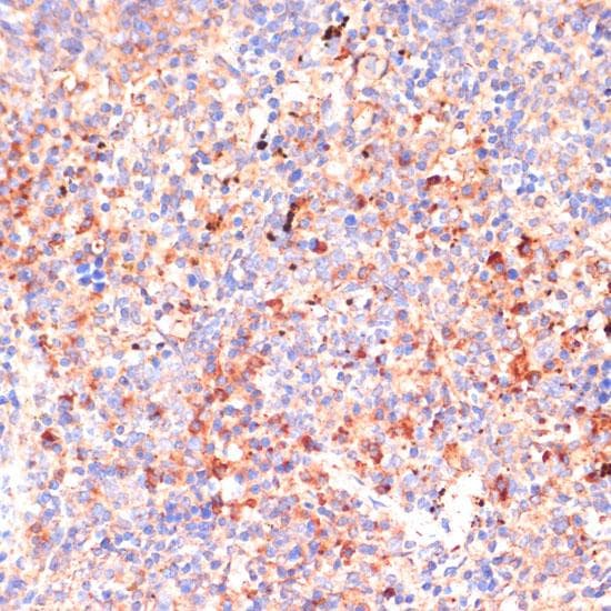 IL4R / CD124 Antibody