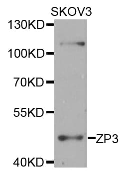 Polyclonal Rabbit anti-Human ZP3 Antibody (WB)