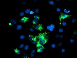 SPRING / TRIM9 Antibody (clone OTI2D6)