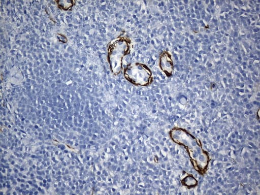 ACTA2 / Smooth Muscle Actin Antibody (N-Terminus, clone UMAB237)