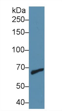 MMP9 / Gelatinase B Antibody (aa225-390)