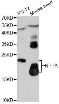 NPPA / ANP Antibody