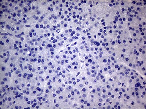 PMP22 Antibody (clone OTI5D1)