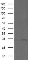 RAB21 Antibody (clone OTI6E12)