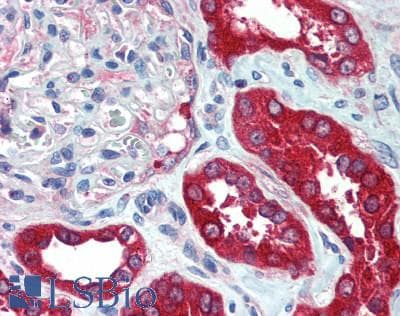 IHC-plus™ CYB5A / Cytochrome b5 Antibody