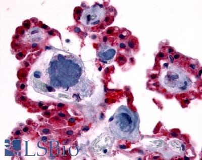 IHC-plus™ Polyclonal Rabbit anti-Human CRHR2 / CRF2 Receptor Antibody (Extracellular Domain, IHC)