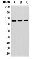 GPLD1 / GPIPLD Antibody (Internal)