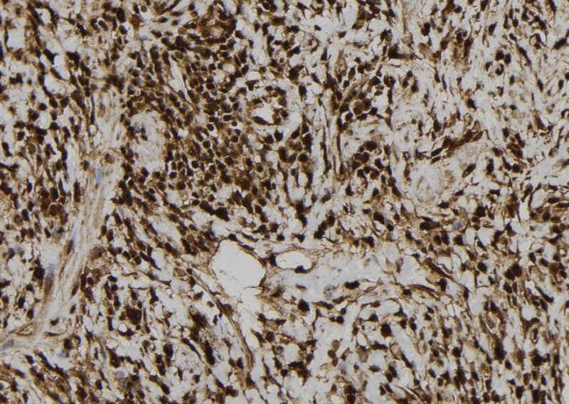 LIG3 / DNA Ligase III Antibody
