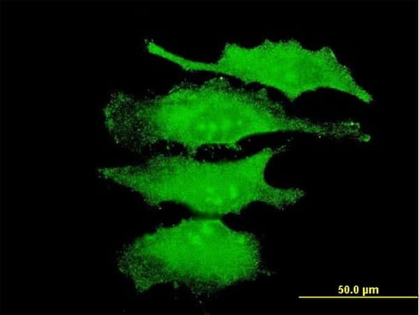 MAPK4 / ERK4 Antibody (clone 2B10)
