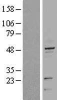 KRT20 / CK20 / Cytokeratin 20 Protein (Over-Expression Lysate Myc-DDK (Flag))