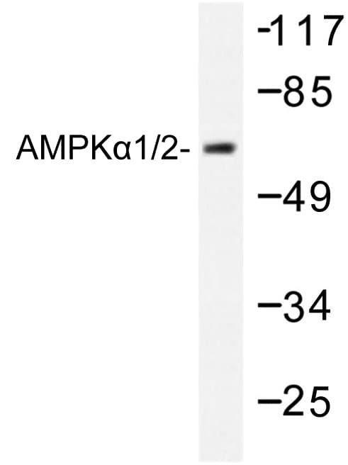 PRKAA1 / AMPK Alpha 1 Antibody (Asp168)
