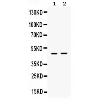 ING1 Antibody (aa192-223)