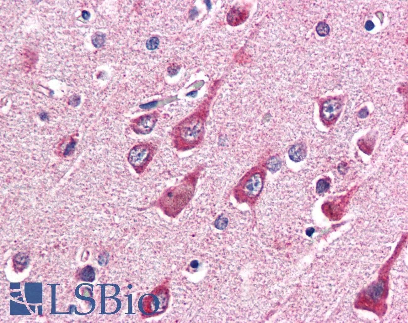 IHC-plus™ OGT / O-GLCNAC Antibody (aa543-555)