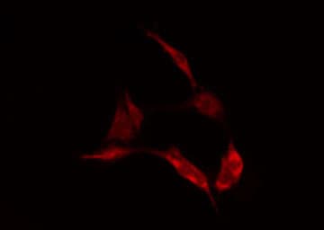 LGALS1 / Galectin 1 Antibody