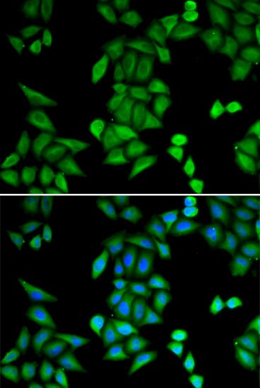 Polyclonal Rabbit anti-Human RBPJ Antibody (IHC, IF, WB)
