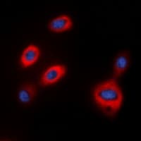 TPH1 / Tryptophan Hydroxylase Antibody (N-Terminus)