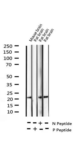 Polyclonal Rabbit anti-Human PPP1R14A / CPI-17 Antibody (phospho-Thr38, IHC, IF, WB)