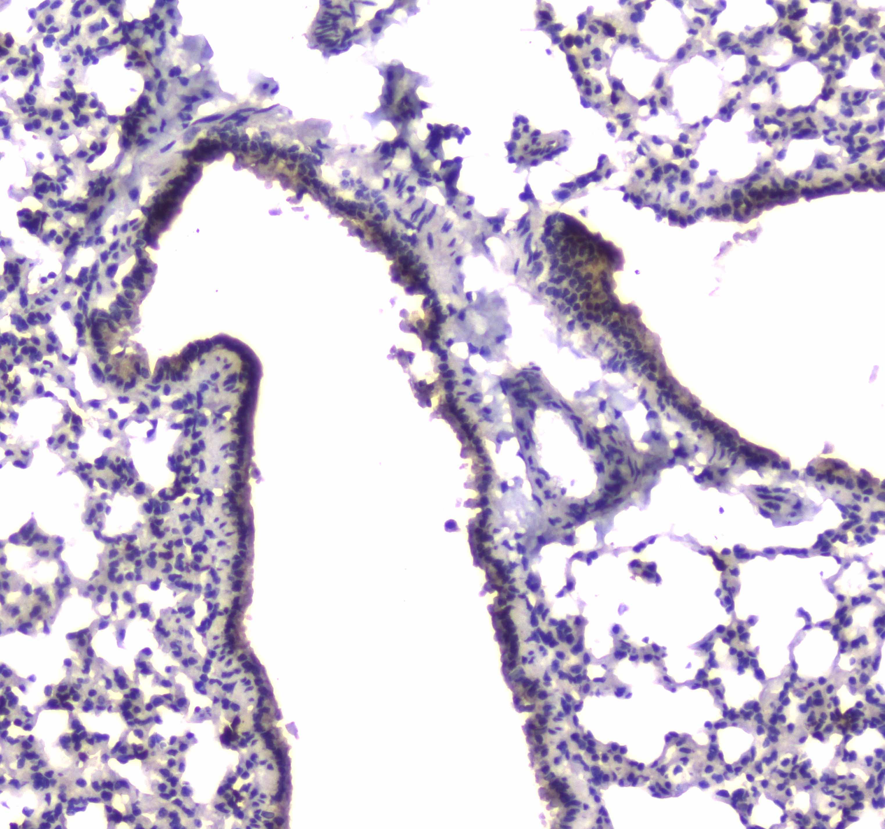 PDE4D Antibody