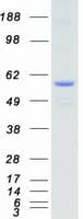 Human NLK Protein (Recombinant Myc-DDK (Flag))