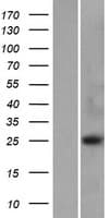 Human VCPKMT / C14orf138 Protein (Over-Expression Lysate Myc-DDK (Flag))