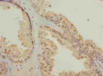 Polyclonal Rabbit anti-Human CGGBP1 Antibody (IHC)