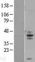 FCMR / FAIM3 Protein (Over-Expression Lysate Myc-DDK (Flag))