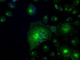 SLC2A5 / GLUT5 Antibody (clone OTI20E1)
