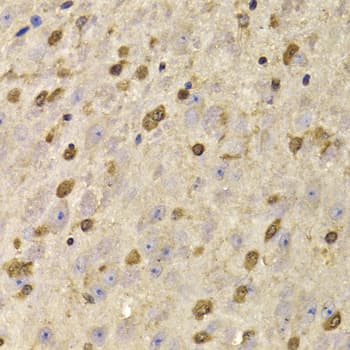 Polyclonal Rabbit anti-Human QKI Antibody (IHC, IF, WB)