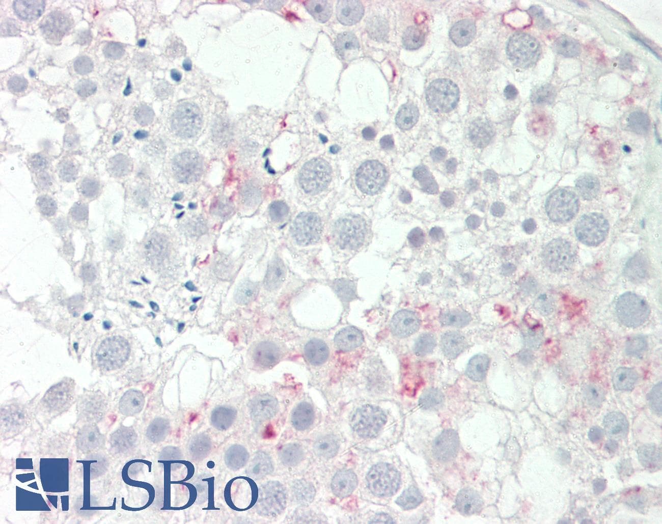 TMEM25 Antibody (aa213-262)