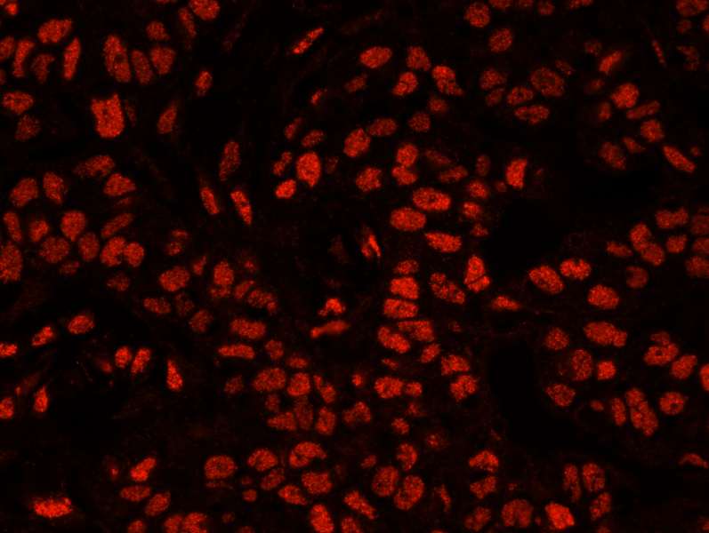IHC-plus™ Polyclonal Rabbit anti-Human XRN2 Antibody (aa900-950, IHC, IF)