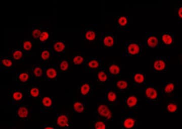 RARB / RAR Beta Antibody