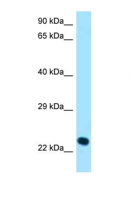 KLRK1 / CD314 / NKG2D Antibody (C-Terminus)