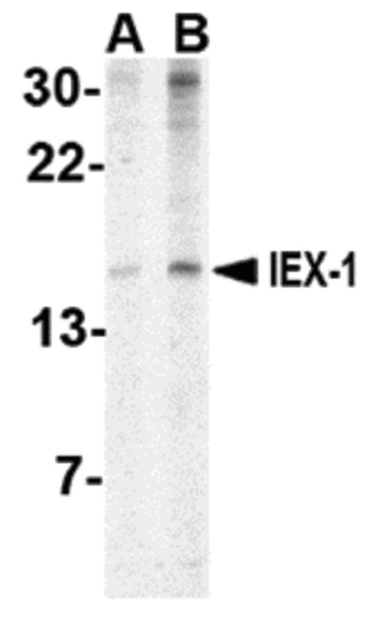 IHC-plus™ IER3 / IEX-1 Antibody