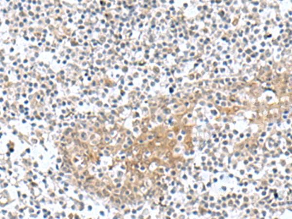 TNNC2 Antibody