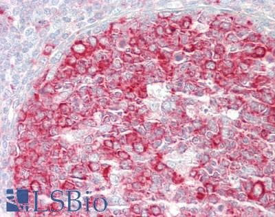 IHC-plus™ Polyclonal Rabbit anti-Human AKT1 Antibody (aa95-144, IHC, IF, WB)