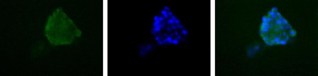 PDHA1 / PDH E1 Alpha Antibody (phospho-Ser293)