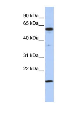 Polyclonal Rabbit anti-Human TRIP10 / CIP4 Antibody (C-Terminus, WB)