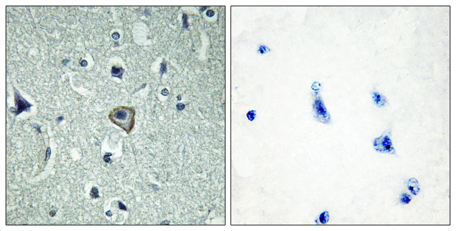 ADGRB2 / BAI2 Antibody
