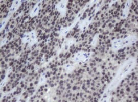 Monoclonal Mouse anti-Human CBX8 Antibody (clone OTI4H3, aa1-260, IHC, WB)