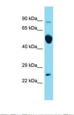 RAB6B Antibody (C-Terminus)