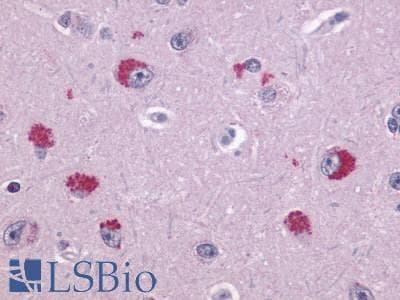 PathPlus™ TAAR1 / TA1 Antibody (Extracellular Domain)